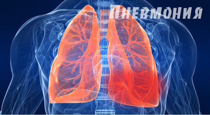 Источник изображения https://zazdorovye.ru/wp-content/uploads/2014/01/pnevmoniya-lechenie.jpg Всемирный день борьбы с пневмонией